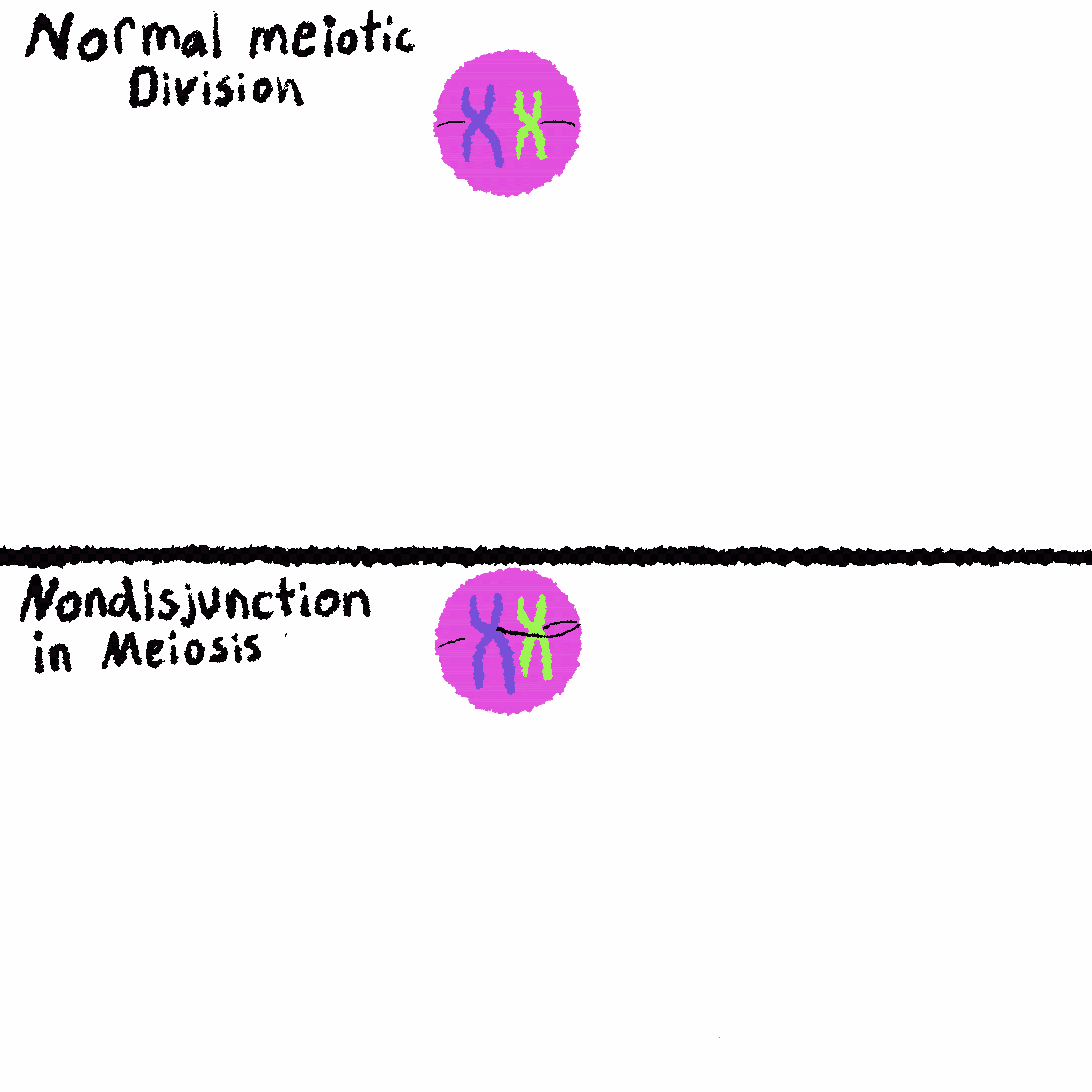 aneuploidy